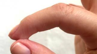 Как очистить кожу рук от суперклея